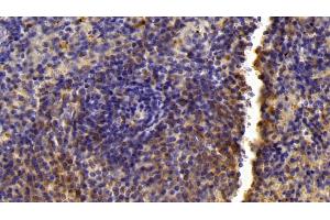 Detection of LXRb in Mouse Spleen Tissue using Polyclonal Antibody to Liver X Receptor Beta (LXRb) (NR1H2 antibody  (AA 1-446))