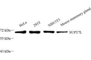 Western blot analysis of SUPT7L (ABIN7075768) at dilution of 1: 2000 (SUPT7L antibody)