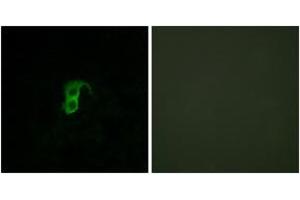 Immunofluorescence analysis of HuvEc cells, using GPR87 Antibody. (GPR87 antibody  (AA 221-270))
