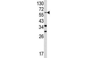Western blot analysis of YAP antibody and NCI-H460 lysate. (YAP1 antibody  (AA 420-446))