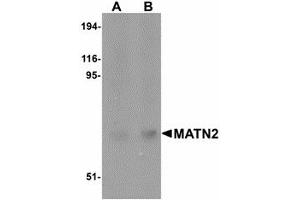 Image no. 1 for anti-Matrilin 2 (MATN2) (C-Term) antibody (ABIN478061) (MATN2 antibody  (C-Term))