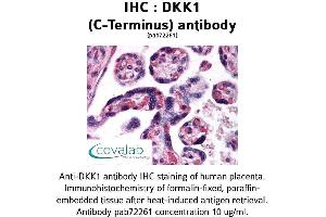 Image no. 1 for anti-Dickkopf Homolog 1 (DKK1) (C-Term) antibody (ABIN1733668)
