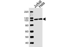 Lane 1: Jurkat Cell lysates, Lane 2: HeLa Cell lysates, probed with USP11 (1220CT620. (USP11 antibody)