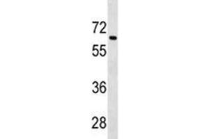 Tgfbr2 antibody western blot analysis in 293 lysate. (TGFBR2 antibody  (AA 548-575))
