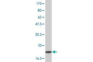 Western Blot detection against Immunogen (19.