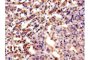 IHC image of ABIN7144757 diluted at 1:300 and staining in paraffin-embedded human adrenal gland tissue performed on a Leica BondTM system. (Aspartate beta Hydroxylase antibody  (AA 75-270))