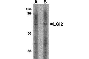 Western Blotting (WB) image for anti-Leucine-Rich Repeat LGI Family, Member 2 (LGI2) (Middle Region) antibody (ABIN1030982) (LGI2 antibody  (Middle Region))