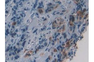 #VALUE! (HSD17B1 antibody  (AA 4-289))