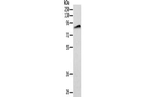 Gel: 10 % SDS-PAGE, Lysate: 40 μg, Lane: Lovo cells, Primary antibody: ABIN7128422(ANTXR1 Antibody) at dilution 1/200, Secondary antibody: Goat anti rabbit IgG at 1/8000 dilution, Exposure time: 2 minutes (ANTXR1 antibody)