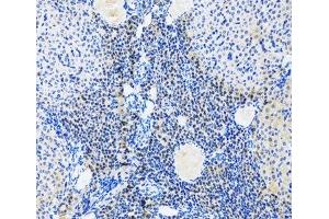 Immunohistochemistry of paraffin-embedded Rat ovary using Myogenin Polyclonal Antibody at dilution of 1:100 (20x lens). (Myogenin antibody)