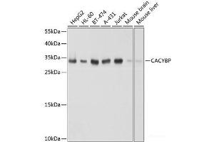 Western blot analysis of extracts of various cell lines using CACYBP Polyclonal Antibody at dilution of 1:1000. (CACYBP antibody)