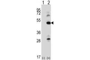 Western blot analysis of ILK antibody and 293 cell lysate either nontransfected (Lane 1) or transiently transfected (2) with the ILK gene.