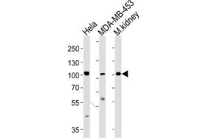 Western Blotting (WB) image for anti-Nuclear Receptor Coactivator 7 (NCOA7) antibody (ABIN3004220)