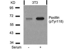 Western blot analysis of extracts from 3T3 cells untreated or treated with serum using Paxillin(Phospho-Tyr118) Antibody. (Paxillin antibody  (pTyr118))