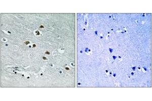 Immunohistochemistry analysis of paraffin-embedded human brain tissue, using HDAC6 (Ab-22) Antibody. (HDAC6 antibody  (AA 7-56))