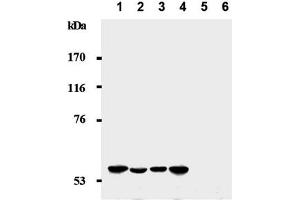 Western Blotting (WB) image for anti-Cyclin-Dependent Kinase Inhibitor 1C (p57, Kip2) (CDKN1C) antibody (ABIN487486) (CDKN1C antibody)
