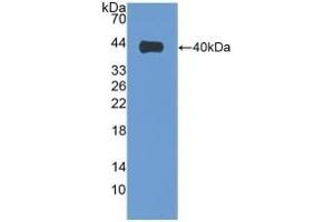 Detection of Recombinant VIL1, Human using Polyclonal Antibody to Villin (VIL) (Villin 1 antibody  (AA 1-320))