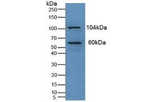 Detection of PKN1 in Human Liver Tissue using Polyclonal Antibody to Protein Kinase N1 (PKN1) (PKN1 antibody  (AA 615-874))