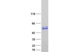 Western Blotting (WB) image for seryl-tRNA Synthetase 2, Mitochondrial (SARS2) protein (Myc-DYKDDDDK Tag) (ABIN2731407)