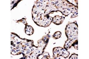 IHC-P: Aromatase antibody testing of human placenta tissue