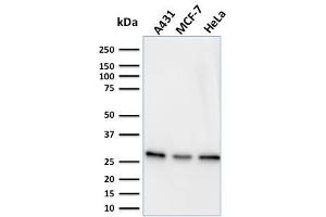 Western Blot Analysis of A431, MCF-7 & HeLa cell lysates using Myofibroblast Marker Mouse Monoclonal Antibody (PR 2D3). (Myofibroblast Marker antibody)
