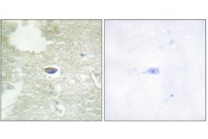 Immunohistochemistry analysis of paraffin-embedded human brain tissue, using TGF beta Receptor II (Phospho-Ser225/250) antibody. (TGFBR2 antibody  (pSer225, pSer250))