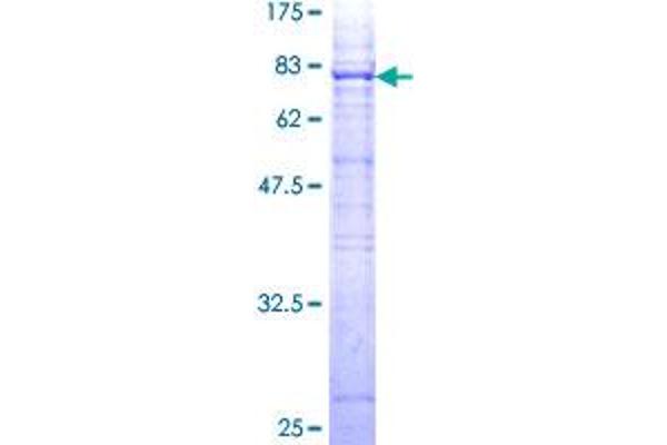 MYOC Protein (AA 1-504) (GST tag)