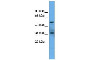 Western Blotting (WB) image for anti-Adenylate Cyclase Activating Polypeptide 1 (Pituitary) Receptor Type I (ADCYAP1R1) (C-Term) antibody (ABIN929396)