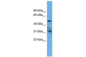 Western Blot showing ADCYAP1R1 antibody used at a concentration of 1-2 ug/ml to detect its target protein. (ADCYAP1R1 antibody  (C-Term))
