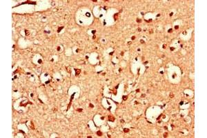 Immunohistochemistry of paraffin-embedded human brain tissue using ABIN7144784 at dilution of 1:100 (Ataxin 1-Like antibody  (AA 183-463))