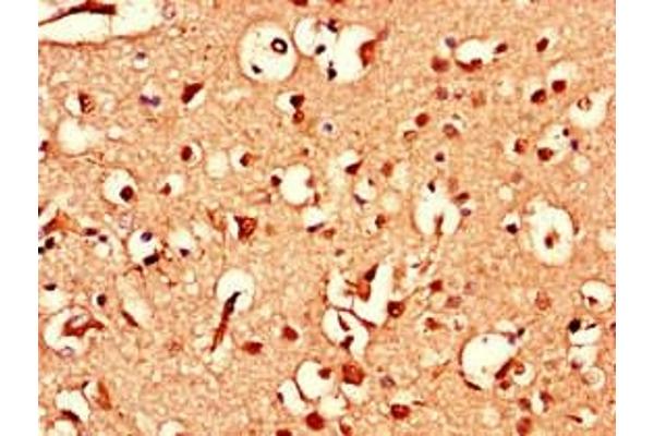 Ataxin 1-Like antibody  (AA 183-463)