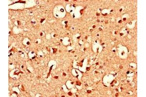 Immunohistochemistry of paraffin-embedded human brain tissue using ABIN7144784 at dilution of 1:100