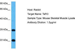 Host: Mouse Target Name: TAF10 Sample Tissue: Mouse Skeletal Muscle Antibody Dilution: 1ug/ml (TAF10 antibody  (Middle Region))