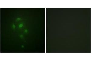 Immunofluorescence analysis of A549 cells, using MSK1 (Phospho-Thr581) Antibody.