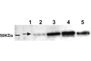 Western Blotting (WB) image for anti-Amylase, alpha (AMY) antibody (ABIN619546) (Amylase, alpha antibody)