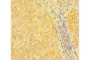 Immunohistochemistry of paraffin-embedded human liver tissue using ABIN7167096 at dilution of 1:100 (RANBP1 antibody  (AA 52-111))