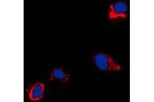 Immunofluorescent analysis of CXADR staining in NIH3T3 cells. (Coxsackie Adenovirus Receptor antibody  (N-Term))