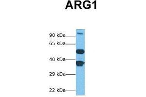 Host:  Rabbit  Target Name:  ARG1  Sample Tissue:  Human Fetal Liver  Antibody Dilution:  1.