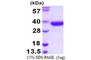 SDS-PAGE (SDS) image for Sulfotransferase Family, Cytosolic, 1A, Phenol-Preferring, Member 2 (SULT1A2) (AA 1-295) protein (His tag) (ABIN5780190)
