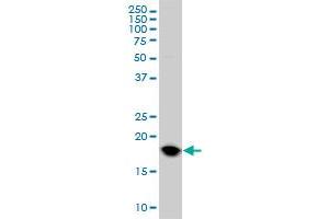 UBE2C monoclonal antibody (M01), clone 9D3 Western Blot analysis of UBE2C expression in HeLa .