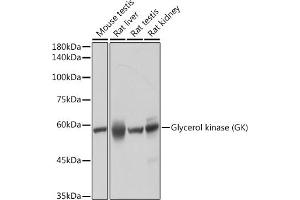 Western blot analysis of extracts of various cell lines, using Glycerol kinase (GK) (GK) antibody (ABIN7267457) at 1:1000 dilution.