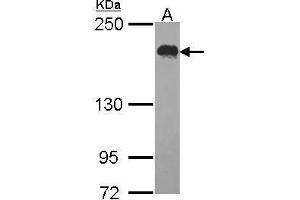 WB Image Sample (30 ug of whole cell lysate) A: Hela 5% SDS PAGE USP47 antibody antibody diluted at 1:1000 (USP47 antibody)