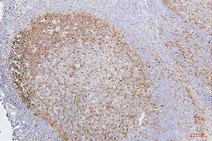 IHC analysis of CDK1 using anti-CDK1 antibody (ABIN7602240). (CDK1 antibody  (AA 66-297))