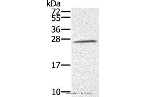 Western blot analysis of K562 cell, using SSX1 Polyclonal Antibody at dilution of 1:350 (SSX1 antibody)