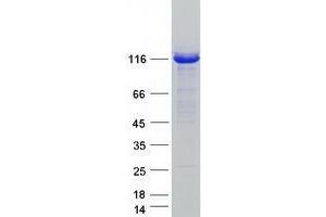 Western Blotting (WB) image for Ubiquitin-Like Modifier Activating Enzyme 6 (UBA6) protein (Myc-DYKDDDDK Tag) (ABIN2734766)