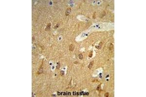 Immunohistochemistry (IHC) image for anti-Tetraspanin 12 (TSPAN12) antibody (ABIN3003872) (TSPAN12 antibody)