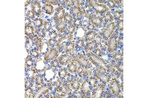 Immunohistochemistry of paraffin-embedded rat kidney using COPS2 antibody at dilution of 1:100 (x400 lens). (COPS2 antibody)