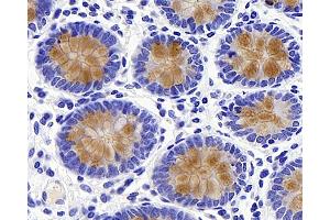 Immunohistochemistry analysis of paraffin-embedded human colon using MUC2 Polyclonal Antibody at dilution of 1:600.