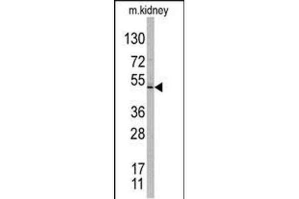 TASP1 antibody  (C-Term)