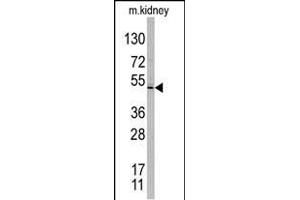 Western blot analysis of TASP1 C-term polyclonal antibody (ABIN388126 and ABIN2846334) in mouse kidney tissue lysates. (TASP1 antibody  (C-Term))